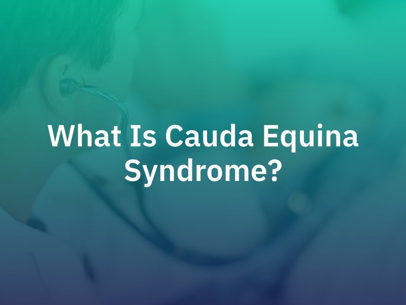 What Is Cauda Equina Syndrome?