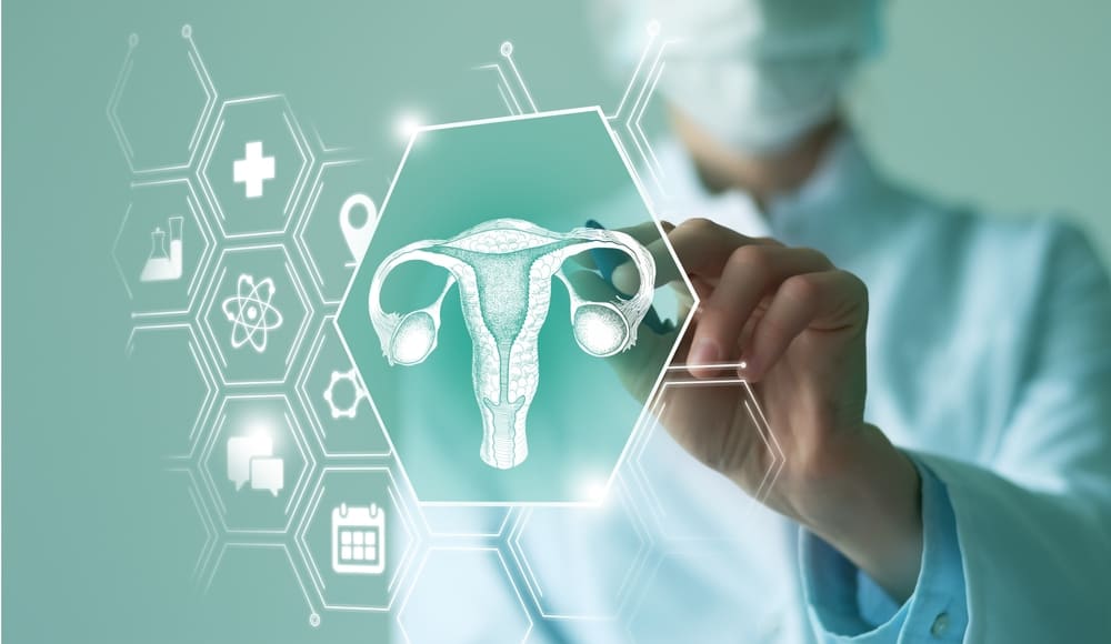 Ovarian Cancer Misdiagnosis