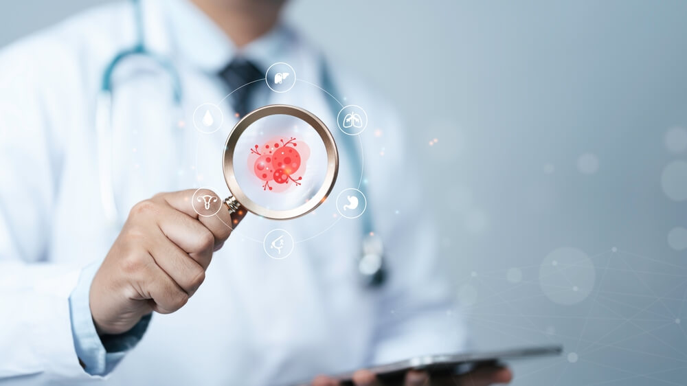 How Often Is Cancer Misdiagnosed?